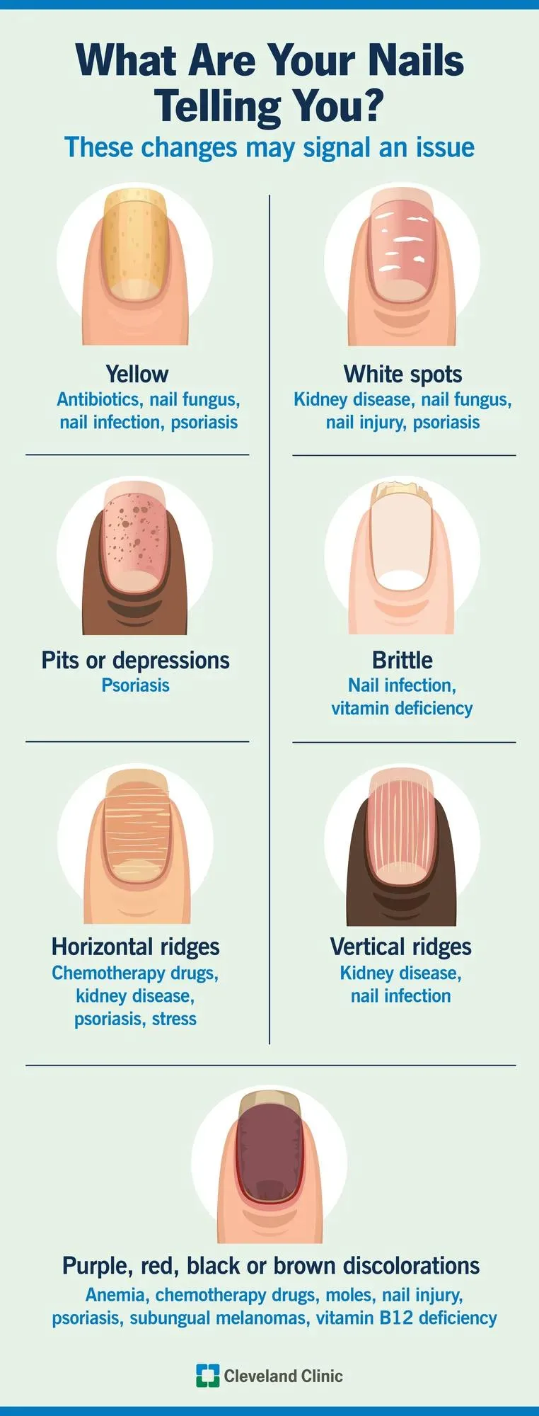 What Are the Signs of Unhealthy Nails After a Manicure What Are the Signs of Unhealthy Nails After a Manicure