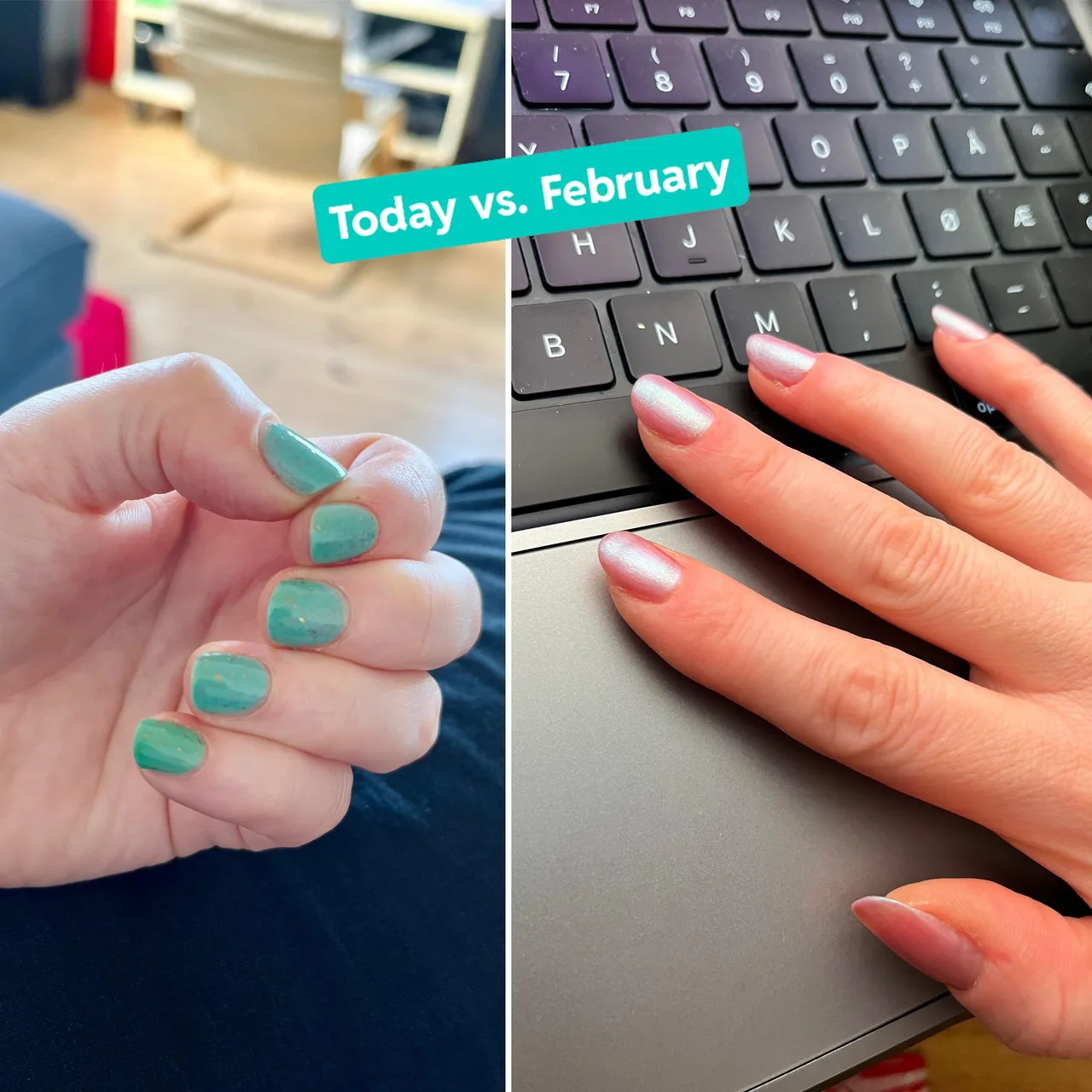 Which Nail Services Offer the Healthiest Options for My Nails Which Nail Services Offer the Healthiest Options for My Nails